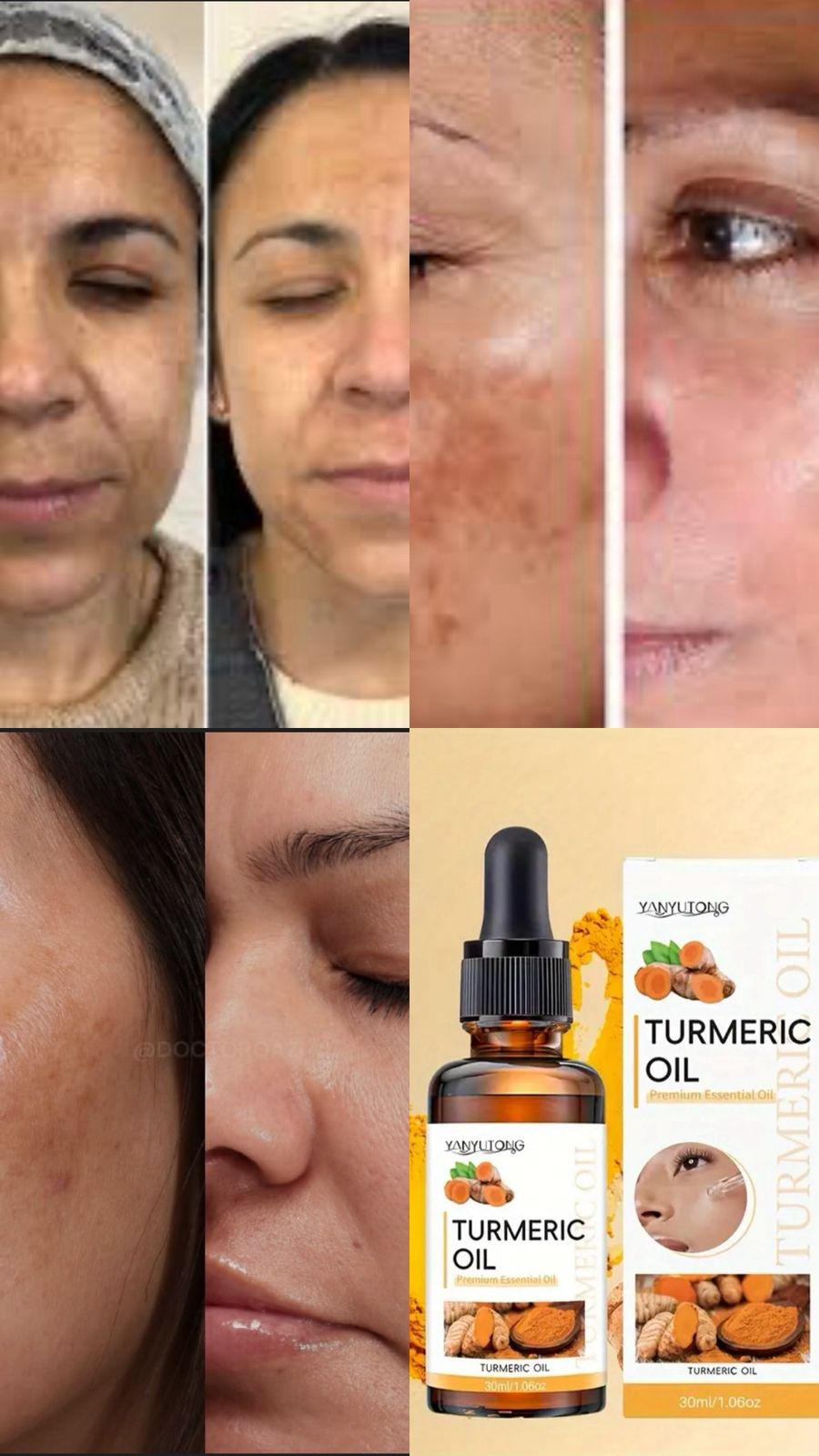 Serum Corrector De Manchas Curcuma